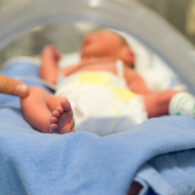 Congenital syphilis cases rising