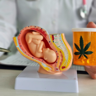 Model of baby in uterus is sitting on a desk next to a pill bottle that has a marijuana leaf next to it. Doctor's hands can be seen in foreground pointing to both
