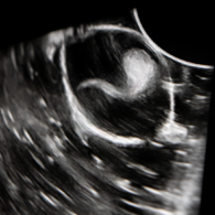 zebra shark pup hatched in Indonesia ultrasound