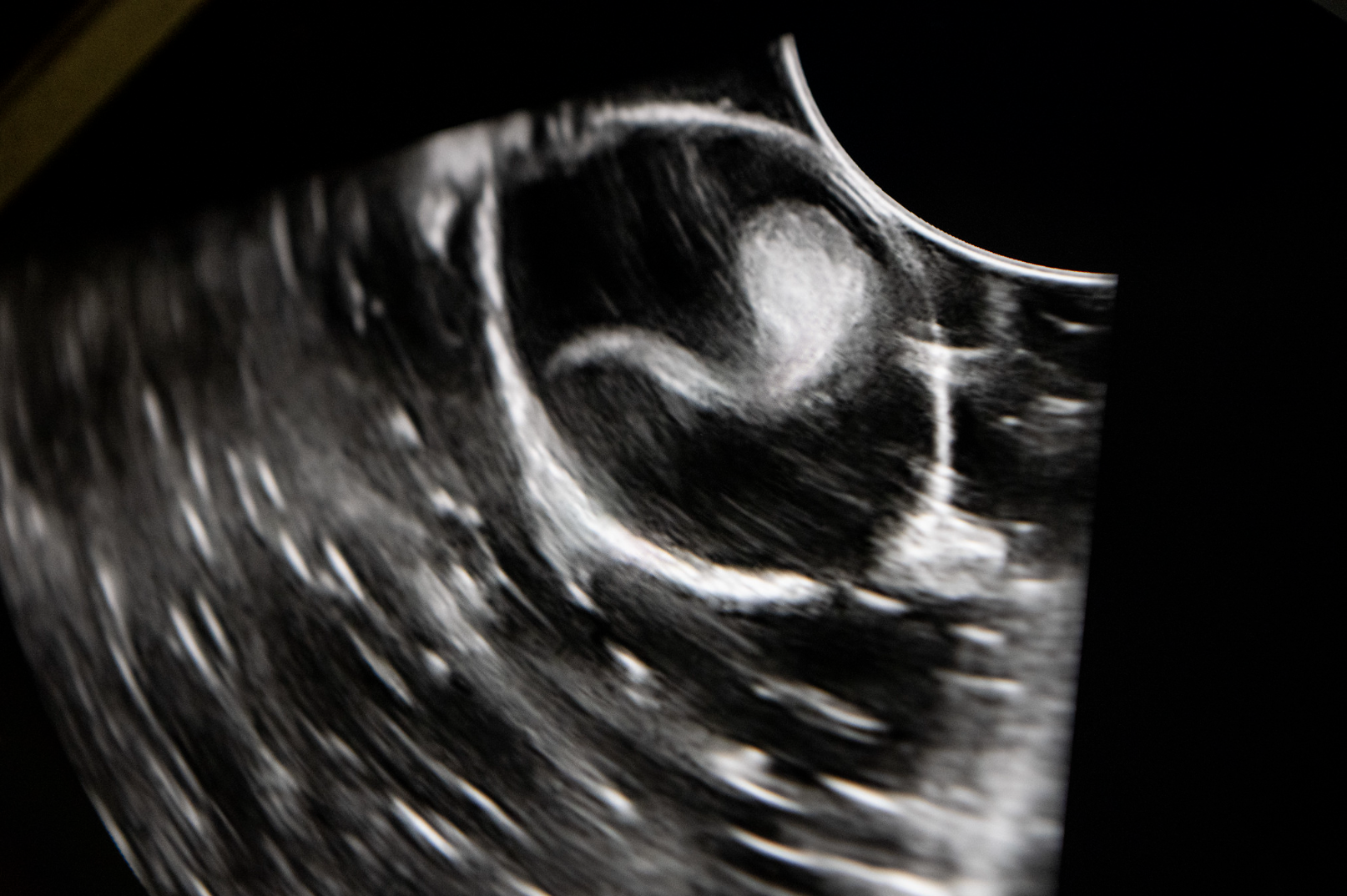 zebra shark pup hatched in Indonesia ultrasound