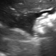 Woodland Park Zoo gorilla birth watch