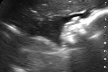 Woodland Park Zoo gorilla birth watch
