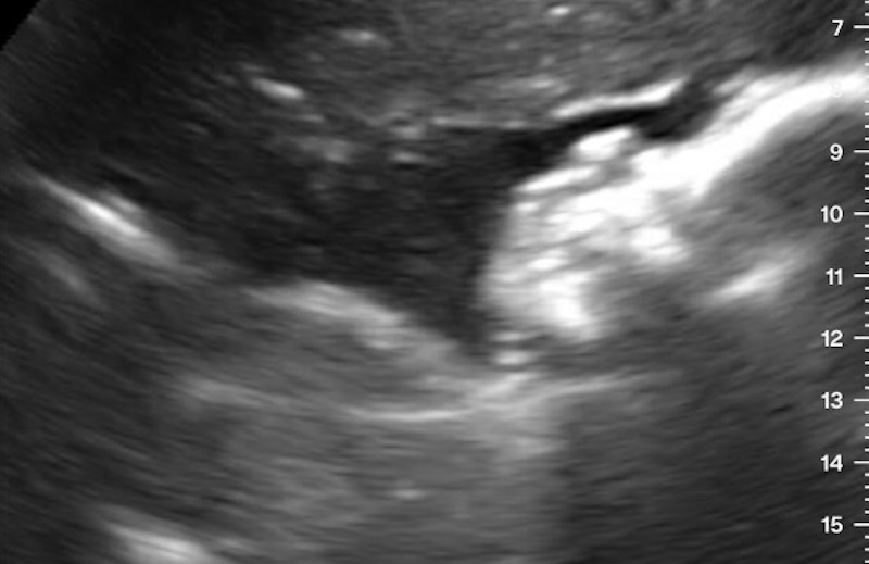 WPZ back on baby watch for expectant gorillas